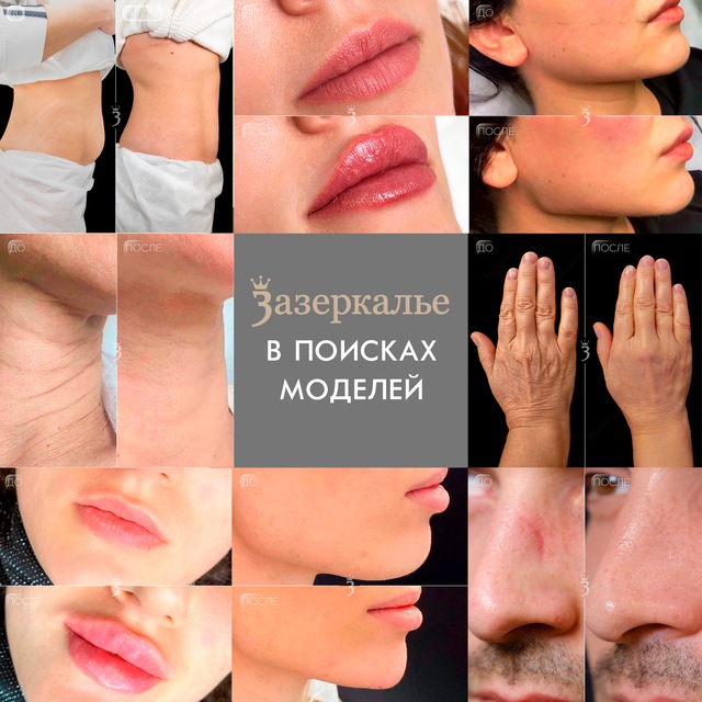 Ищем моделей в центр красоты (КЛИНИКА / САЛОН) Кантемировская / Тульская